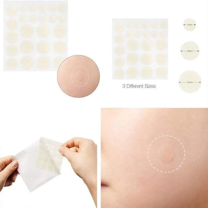 Acne Patch